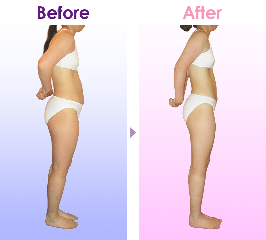 Before After イメージ2