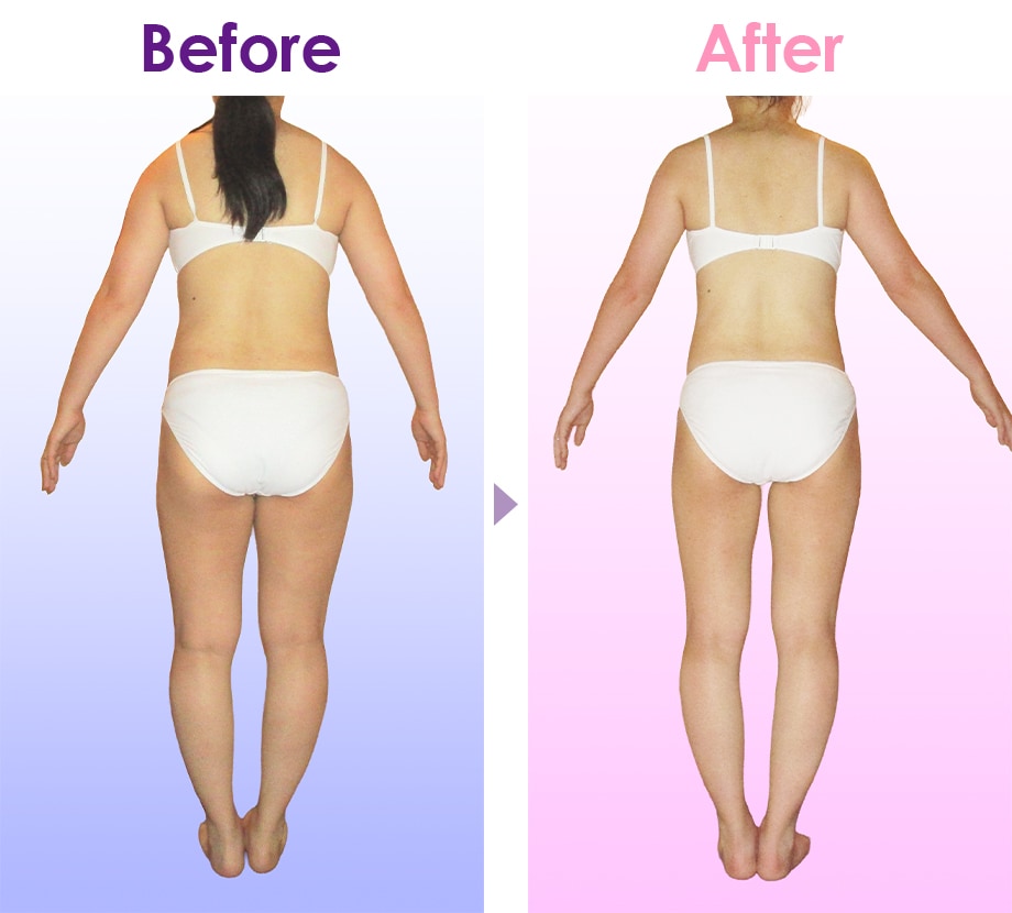 Before After イメージ3