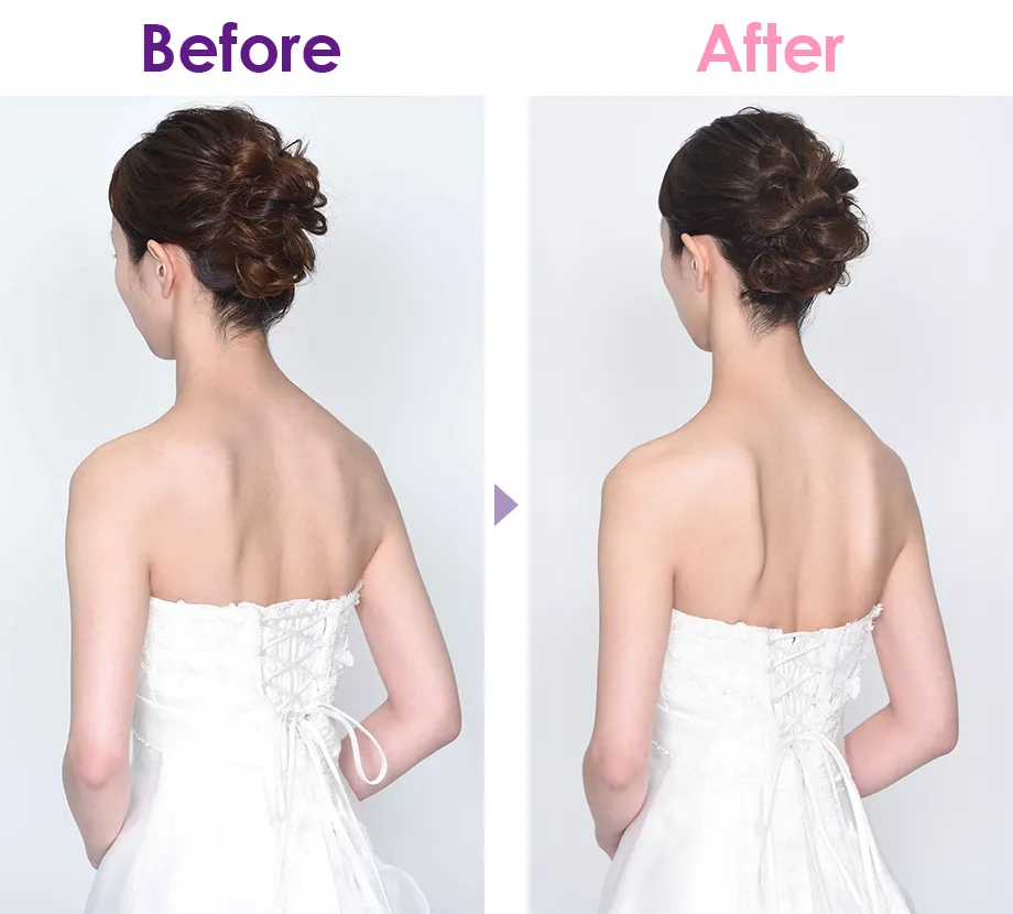 Before After イメージ1