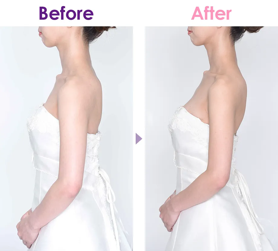 Before After イメージ2