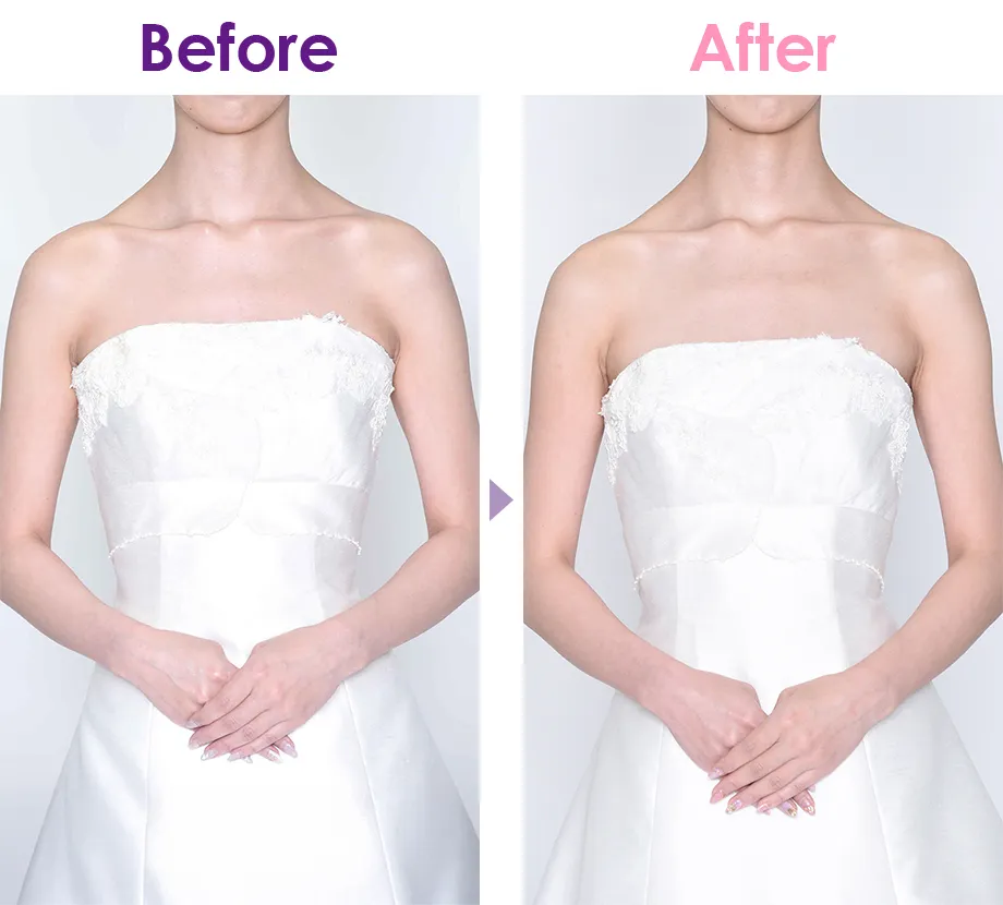 Before After イメージ3