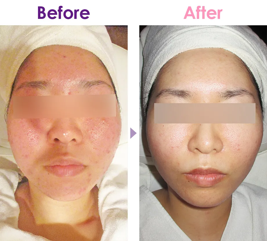 Before After イメージ1