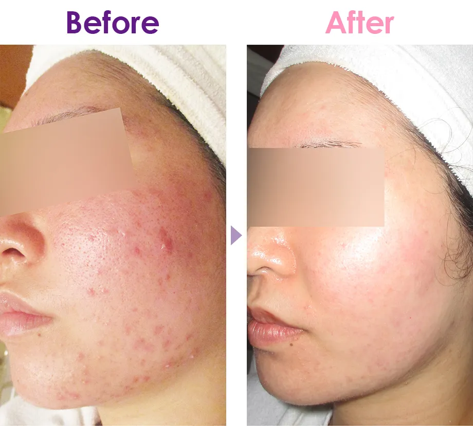 Before After イメージ2