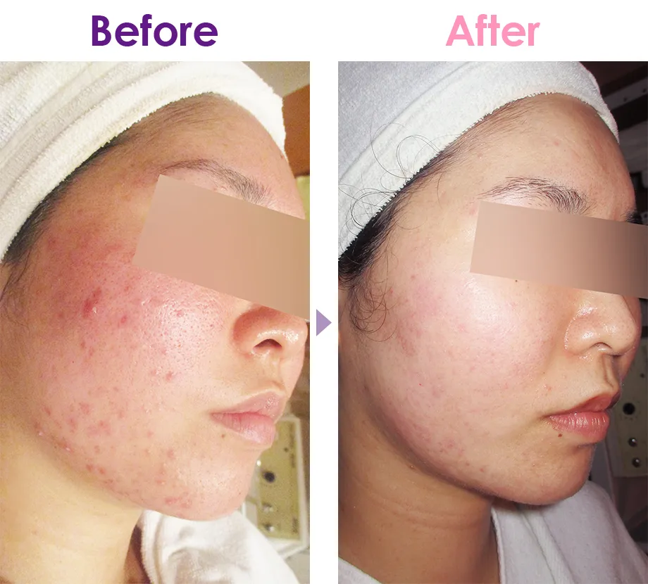 ラ・パルレ自宅用 ダイエット ラ・パルレ自宅用 ダイエット卸売 通販