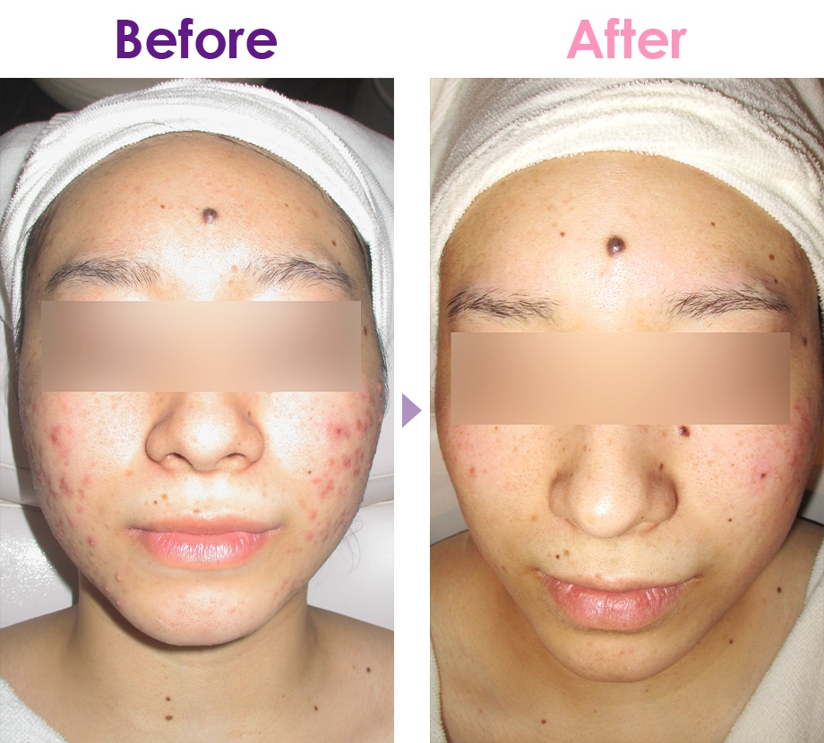 Before After イメージ1