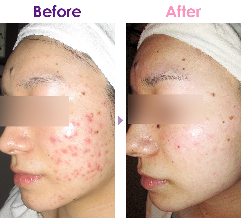 Before After イメージ2