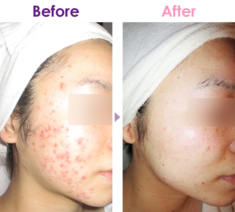 Before After イメージ3