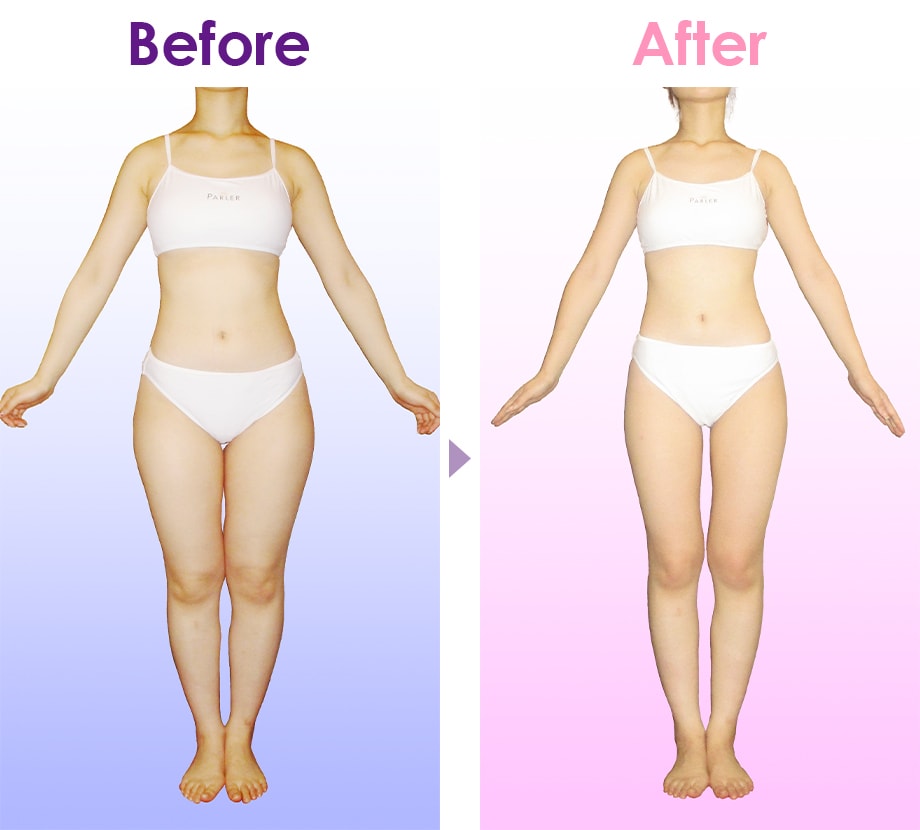 Before After イメージ1