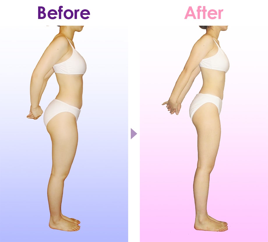 Before After イメージ2