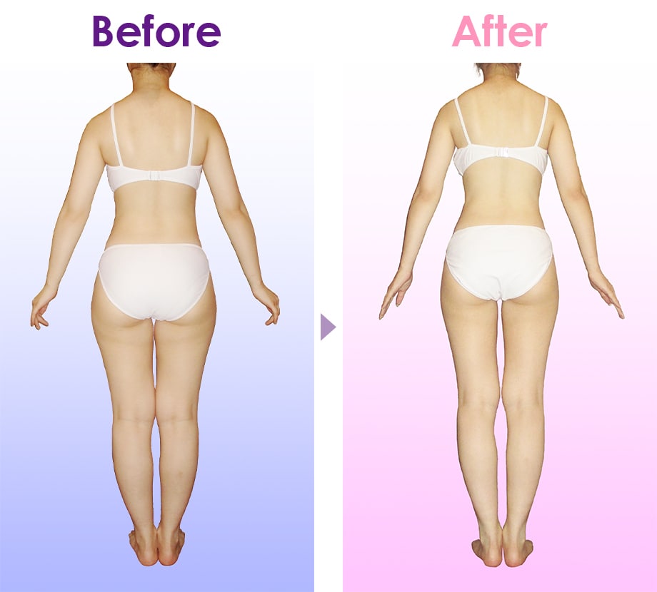 Before After イメージ3