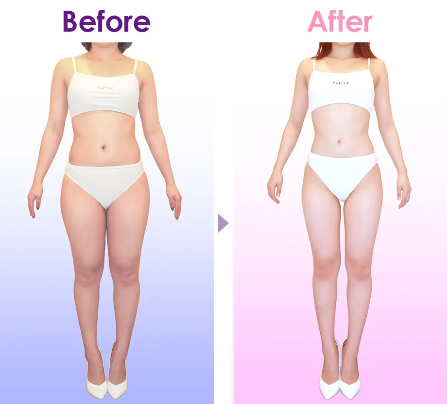 Before After イメージ1