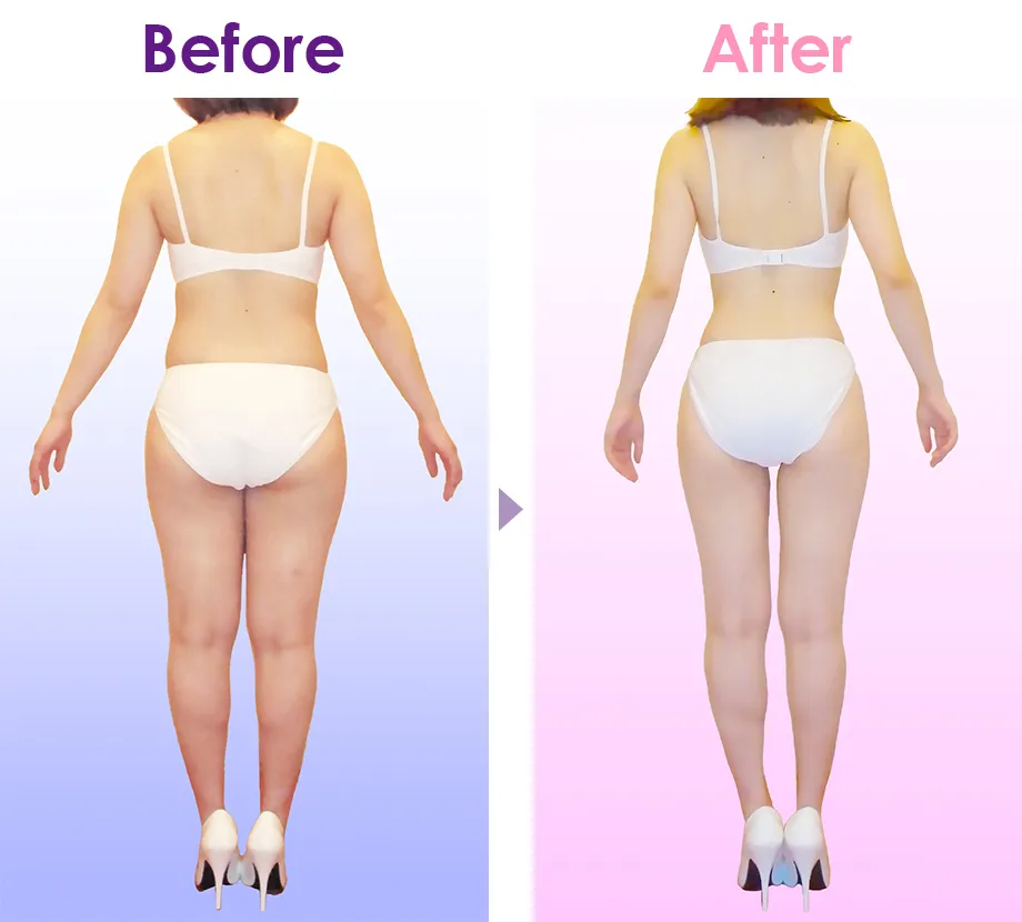 ラ・パルレの口コミ｜脚やせ・痩身・ブライダルエステの体験談